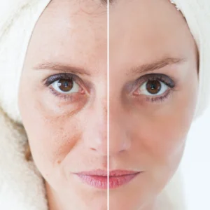 Tratament avansat anti-rid