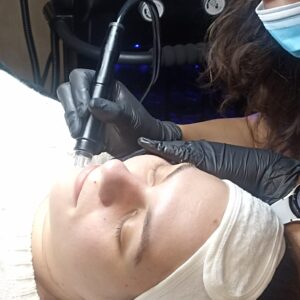 Aqua Peeling